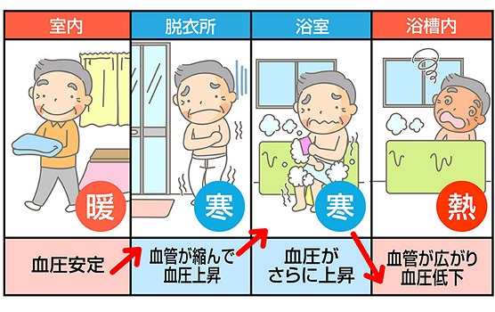 浴室の寒暖差よるヒートショックの画像